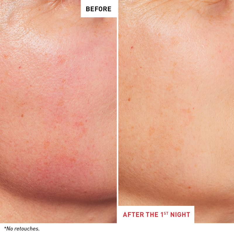 Erborian Skin Therapy Before After
