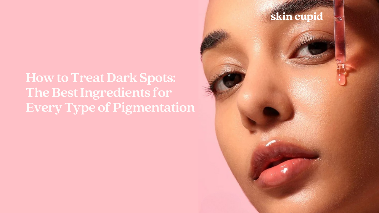 Acne Talk: What Causes Acne and How to Treat It at Home? Acne Talk: What Causes It and How to Treat It at Home First...